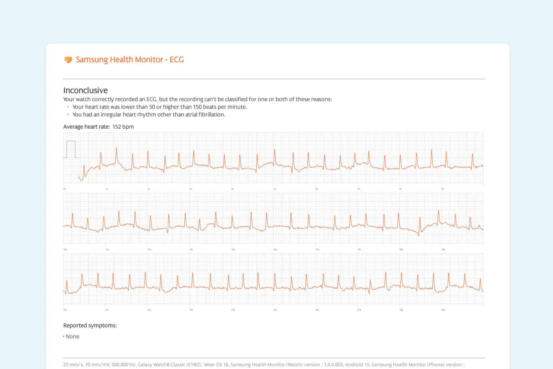afib on Samsung Health Monitori