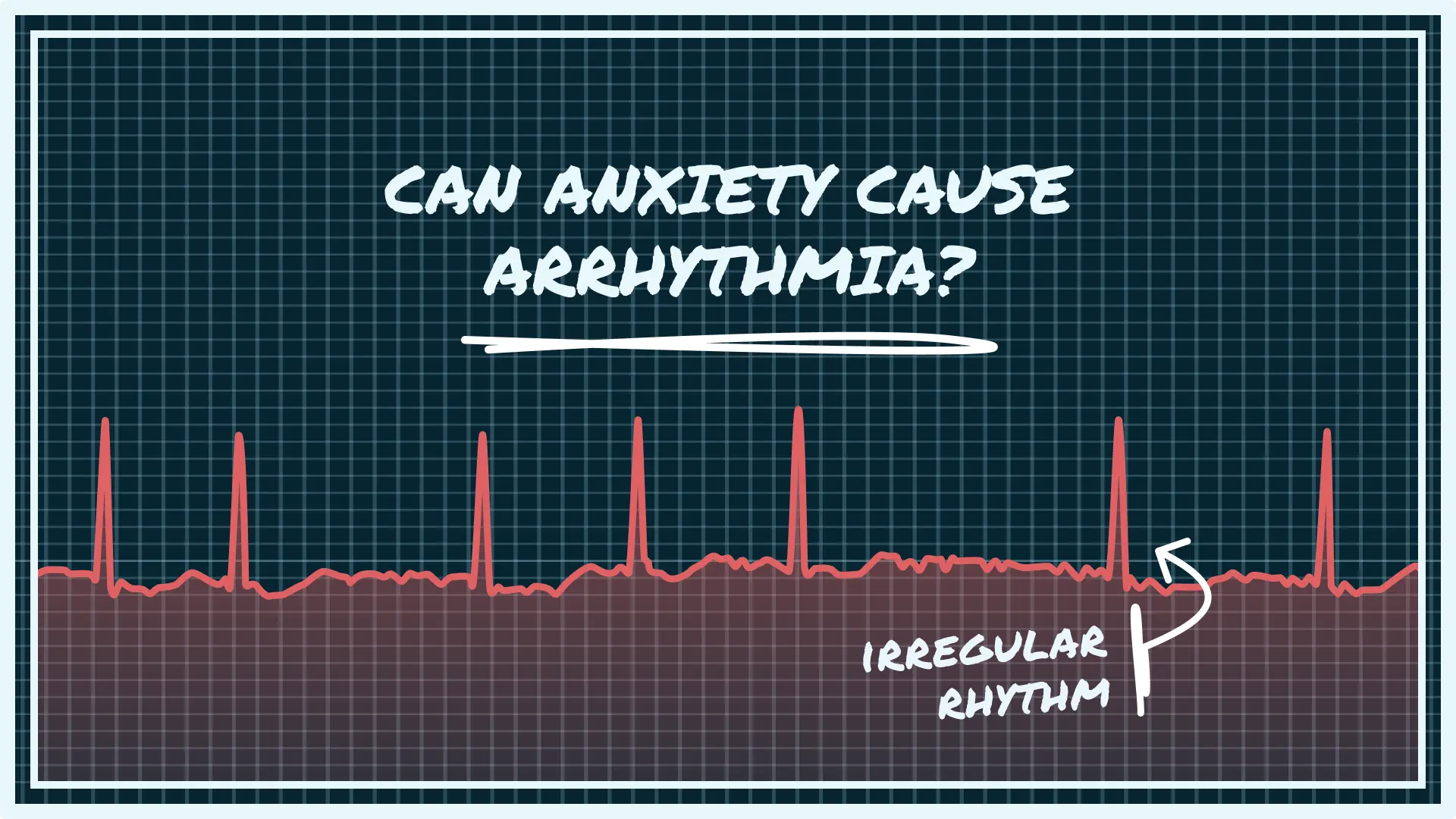 Wondering if can anxiety cause arrhythmia? Learn the connection, symptoms, and what actions to take. Read our expert guide now.