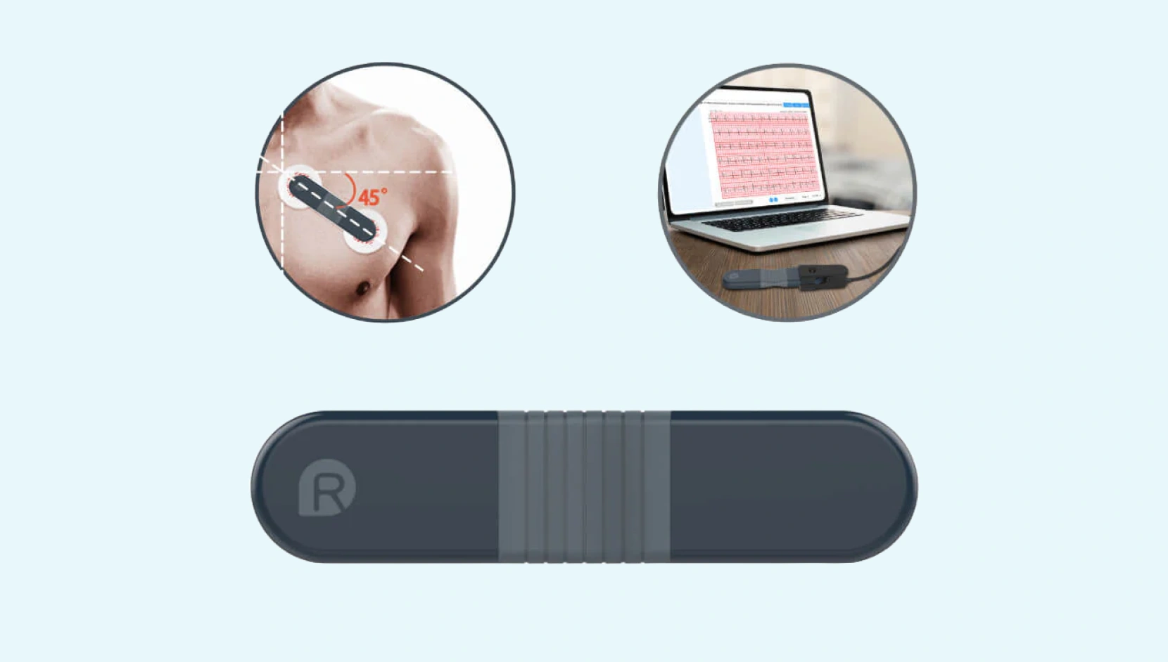 Example of wearable ECG patch from Wellue company