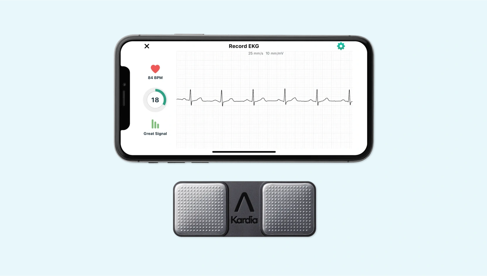 Handheld ECG device
