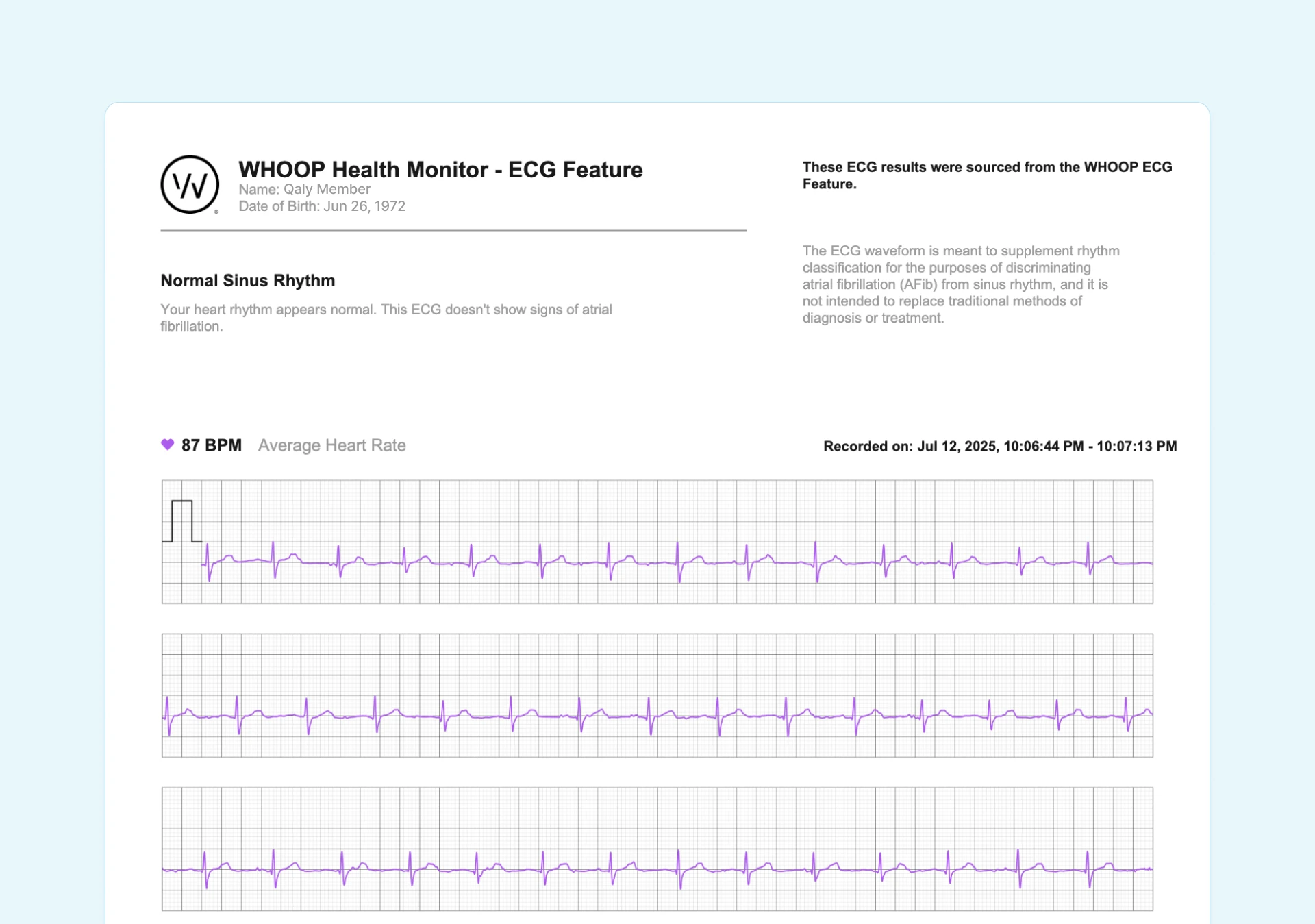 ECG report from Whoop device