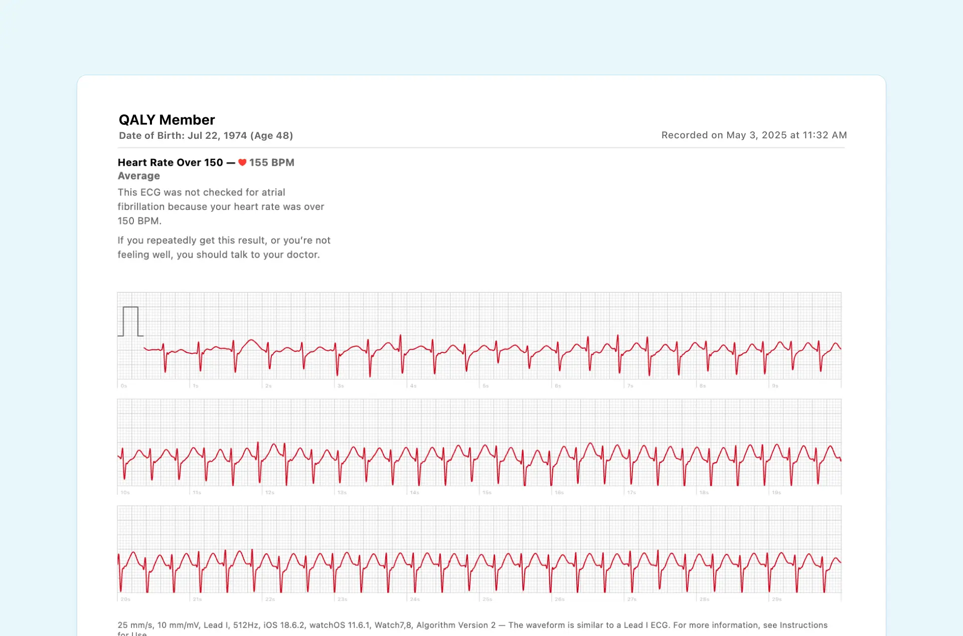 Example of "Heart Rate Over 150" Result on Apple Watch ECG