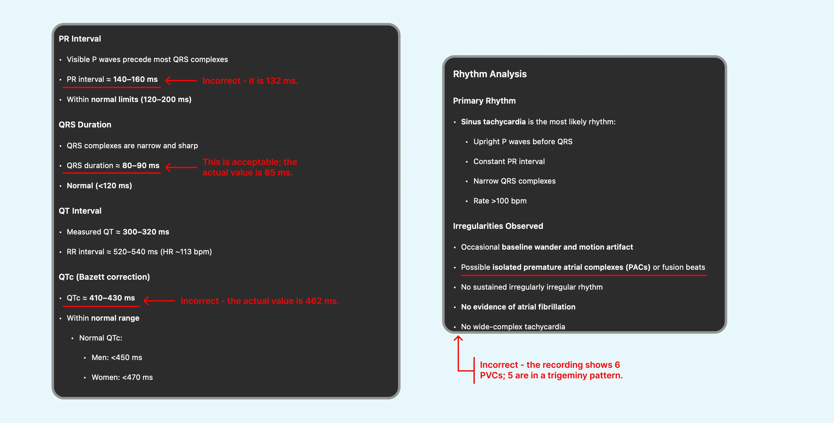 Failed review of ECG with Sinus Tachycardia with PVCs by ChatGPT's ECG Reader