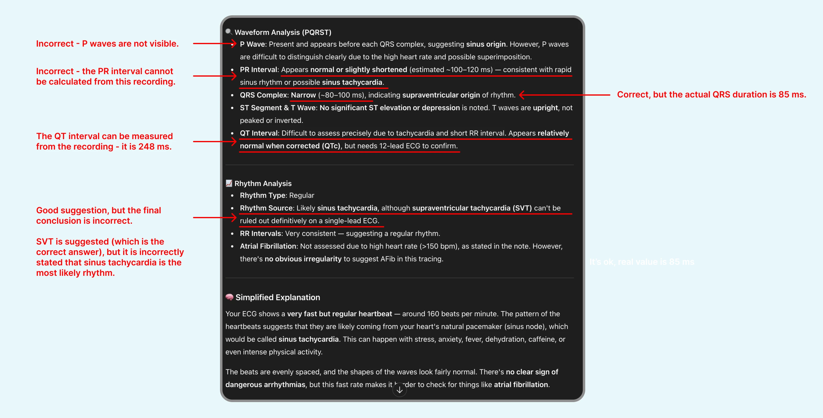 Failed review of ECG with SVT by ChatGPT's ECG Reader