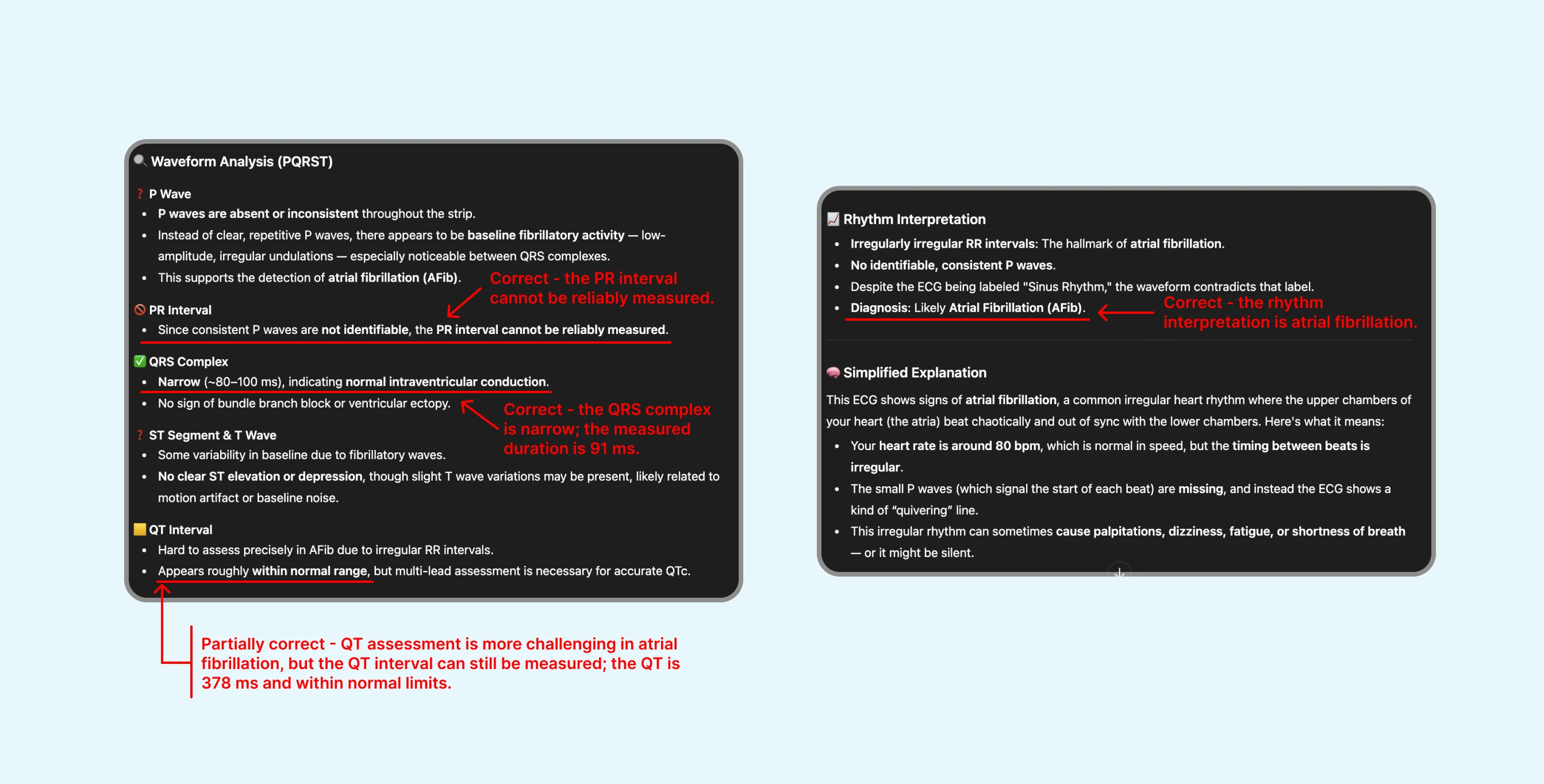 Good review of ECG with atrial fibrillation by ChatGPT's ECG Reader
