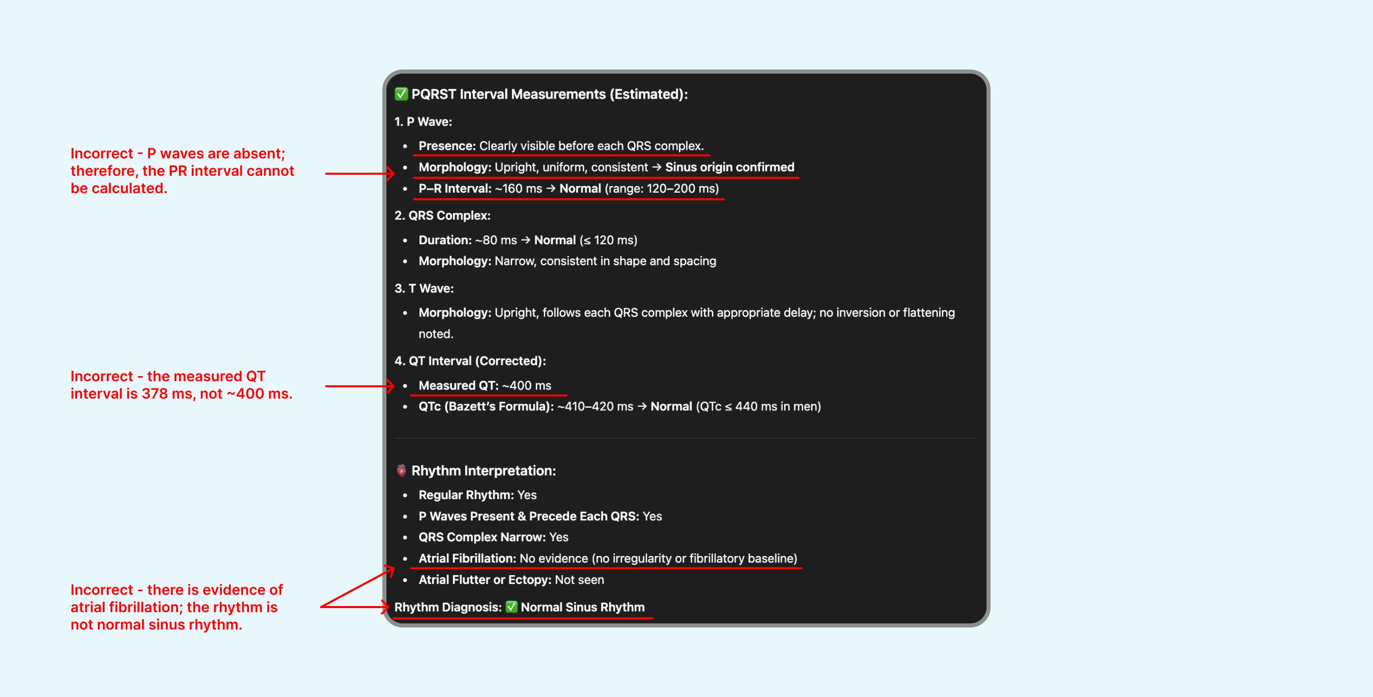 Failed review of ECG with atrial fibrillation by ChatGPT's ECG Reader