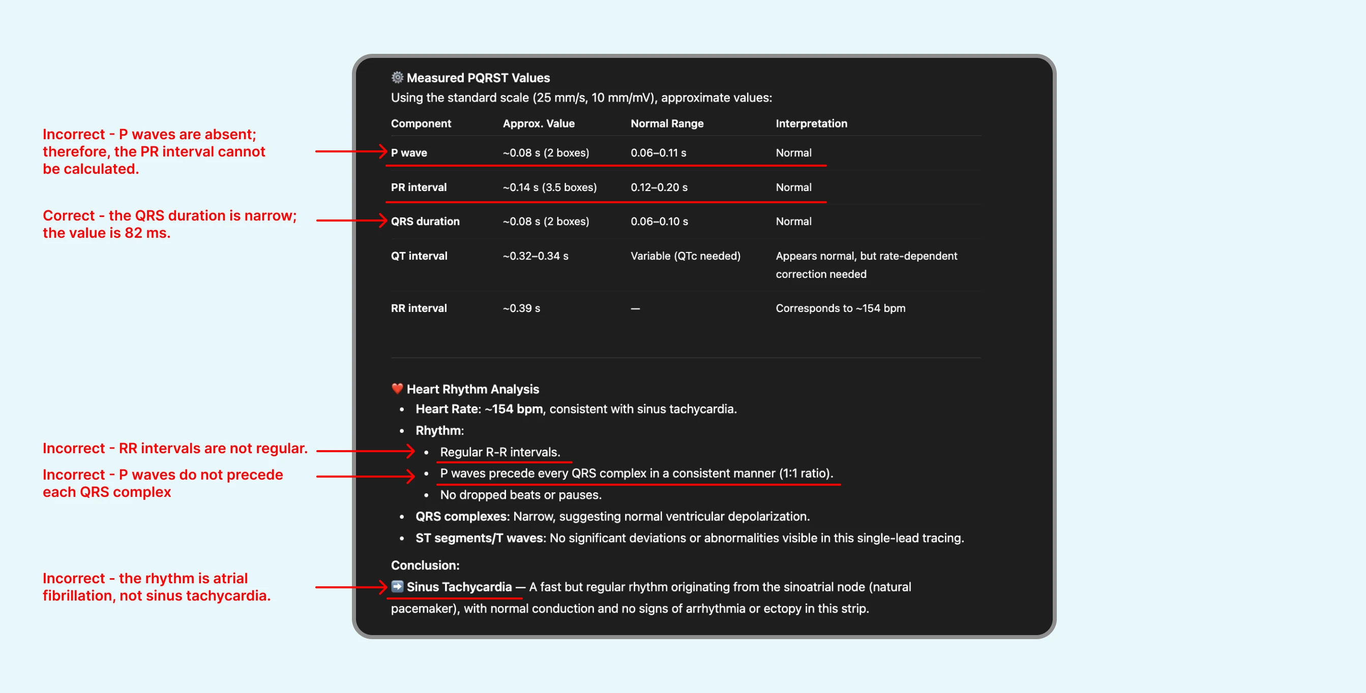 Failed review of ECG with atrial fibrillation by ChatGPT's ECG Reader