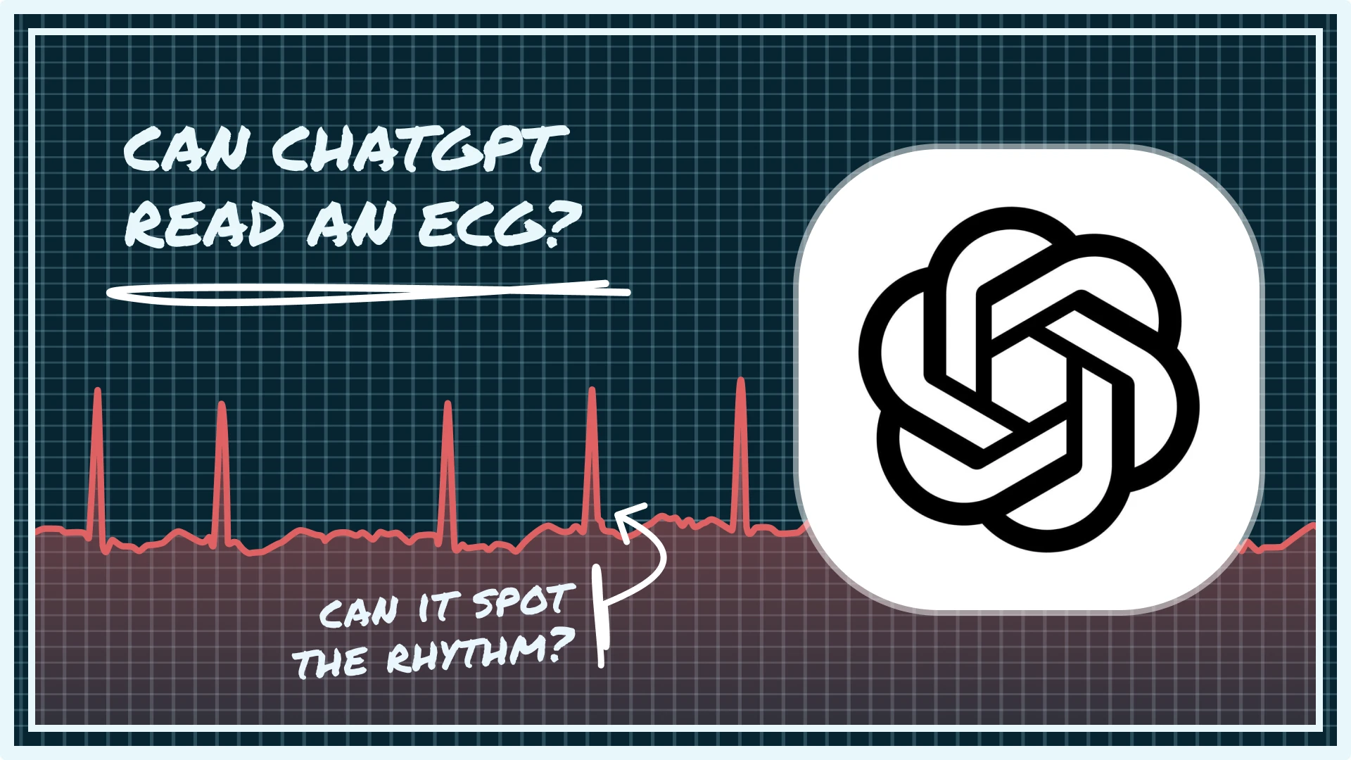 Can ChatGPT read your ECGs