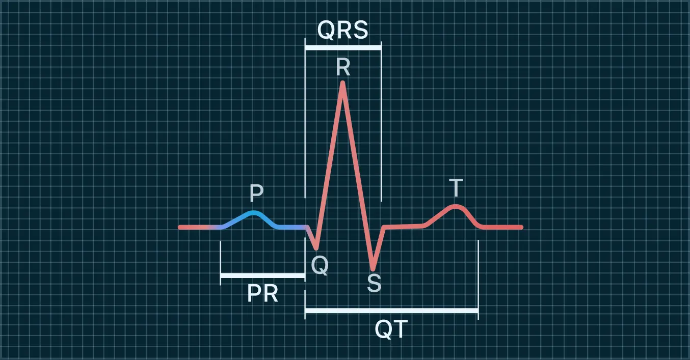 Your PR Interval, in blue.