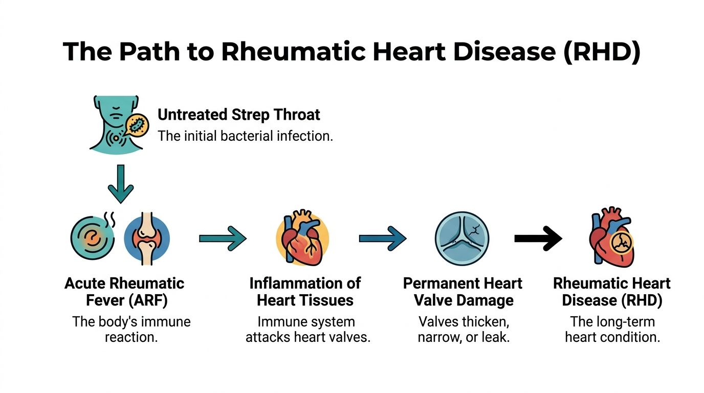 An infographic showing the progression from untreated strep throat to permanent rheumatic heart disease.