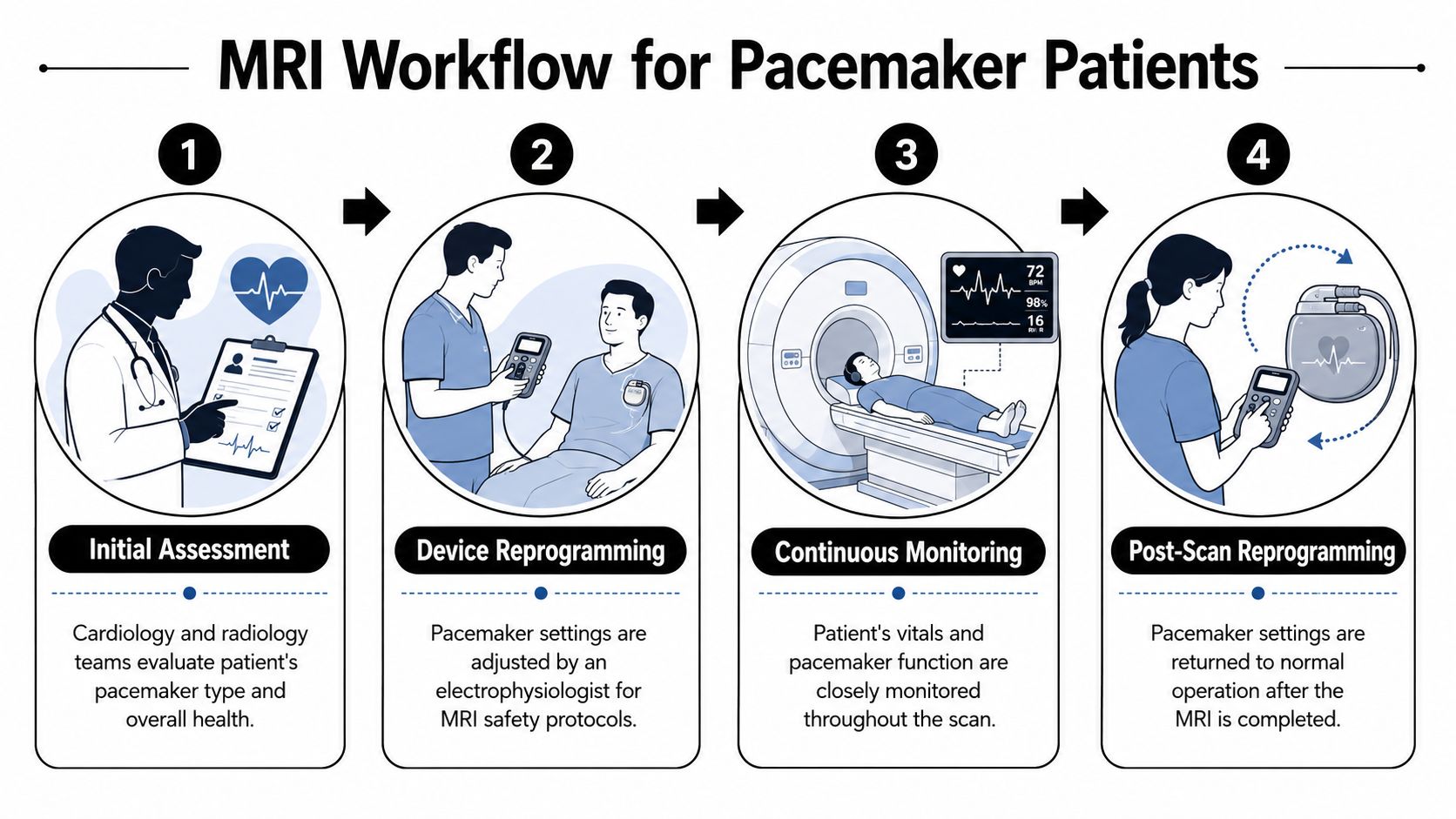 A four-step infographic illustrating the MRI workflow process for patients with implanted pacemakers.