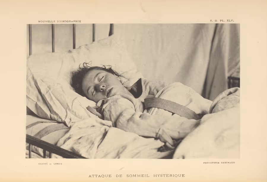 Historical picture showing a woman suffering from hysterical narcolepsia