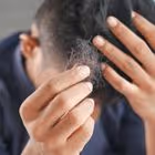 Tricotillomania