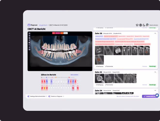 Benutzeroberfläche eines CBCT AI Berichts mit 3D-Zahnscan, detaillierten Zahnstatusanzeigen und Röntgenbildern zur Diagnose dentaler Befunde.