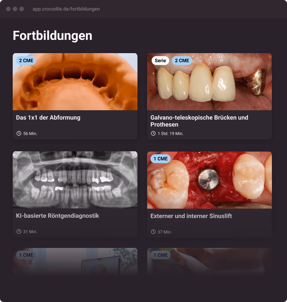 Kursübersicht für Fortbildungen zu Zahnabformung, Brücken, KI-Röntgen, Sinuslift mit Dauerangaben.