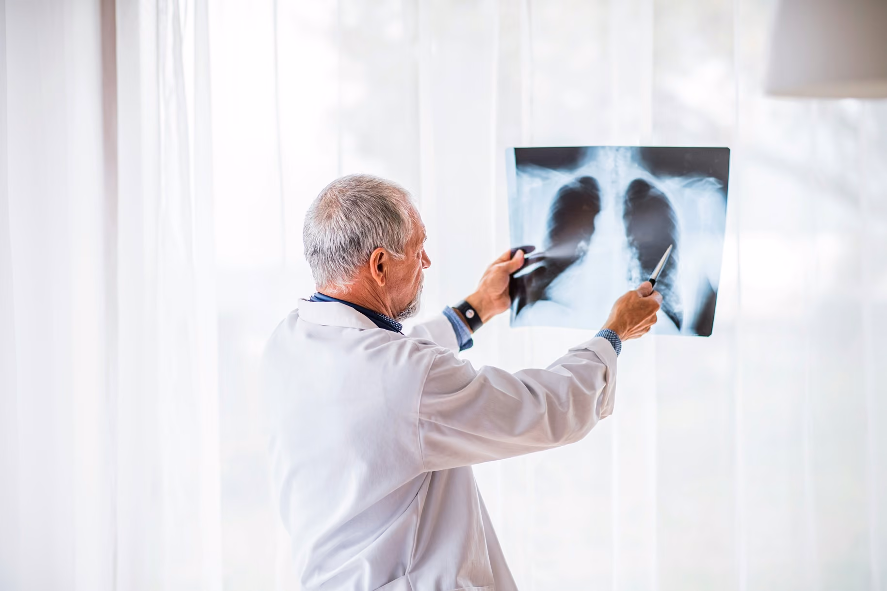 Doctor in white coat examining a chest X-ray against bright window curtains.