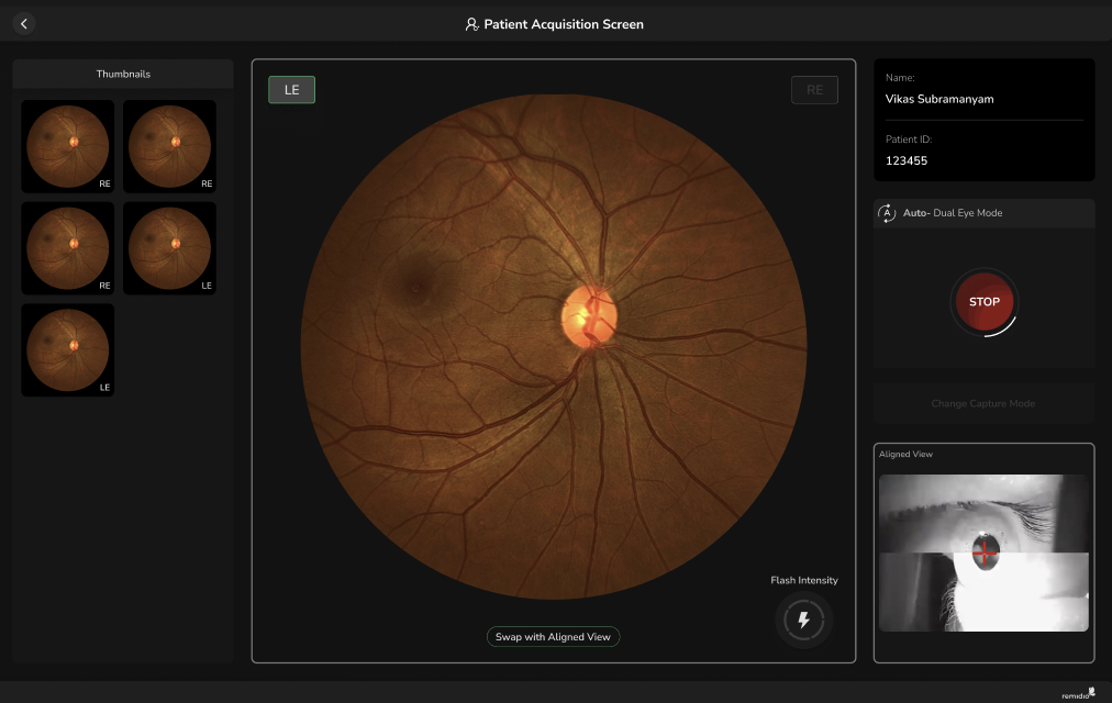 remidio retinal camera
