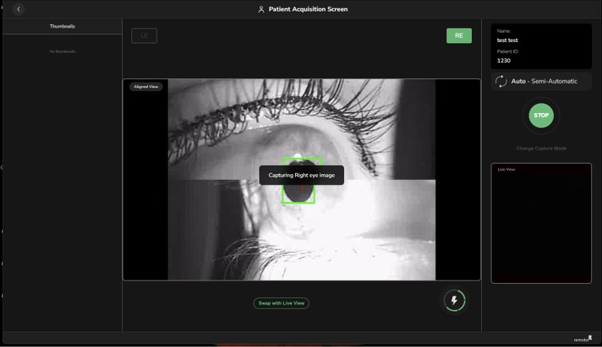 internal fixation & auto montage fundus image