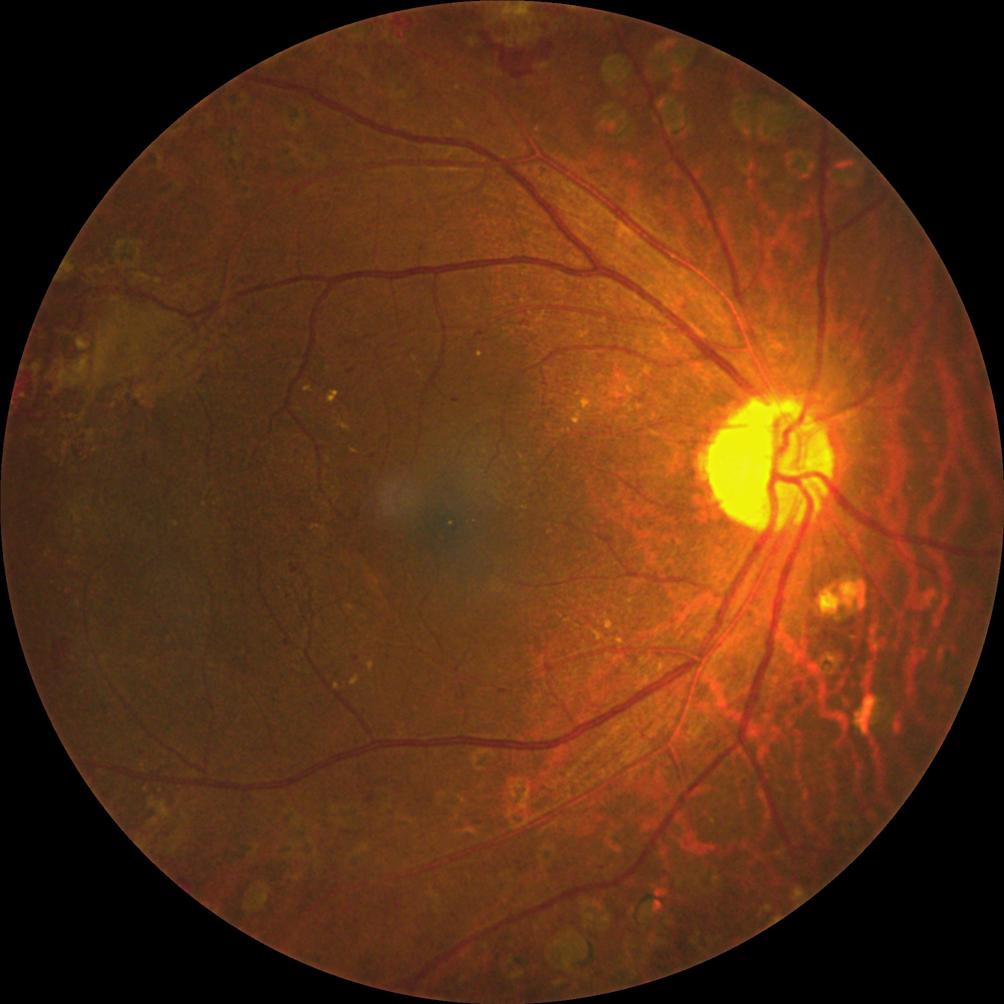 Fundus image