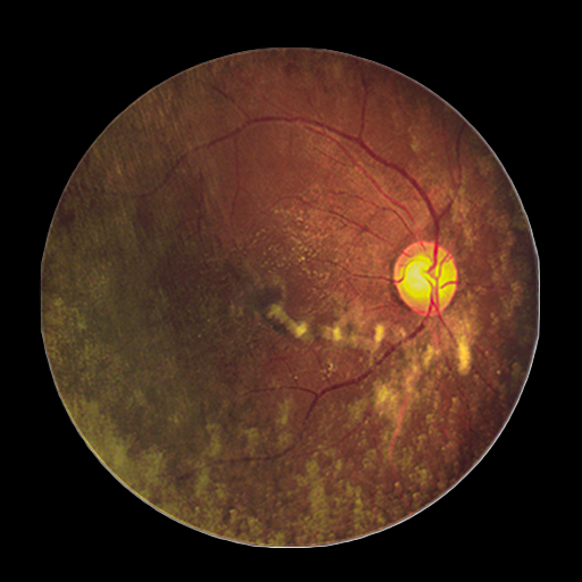 Retinal image