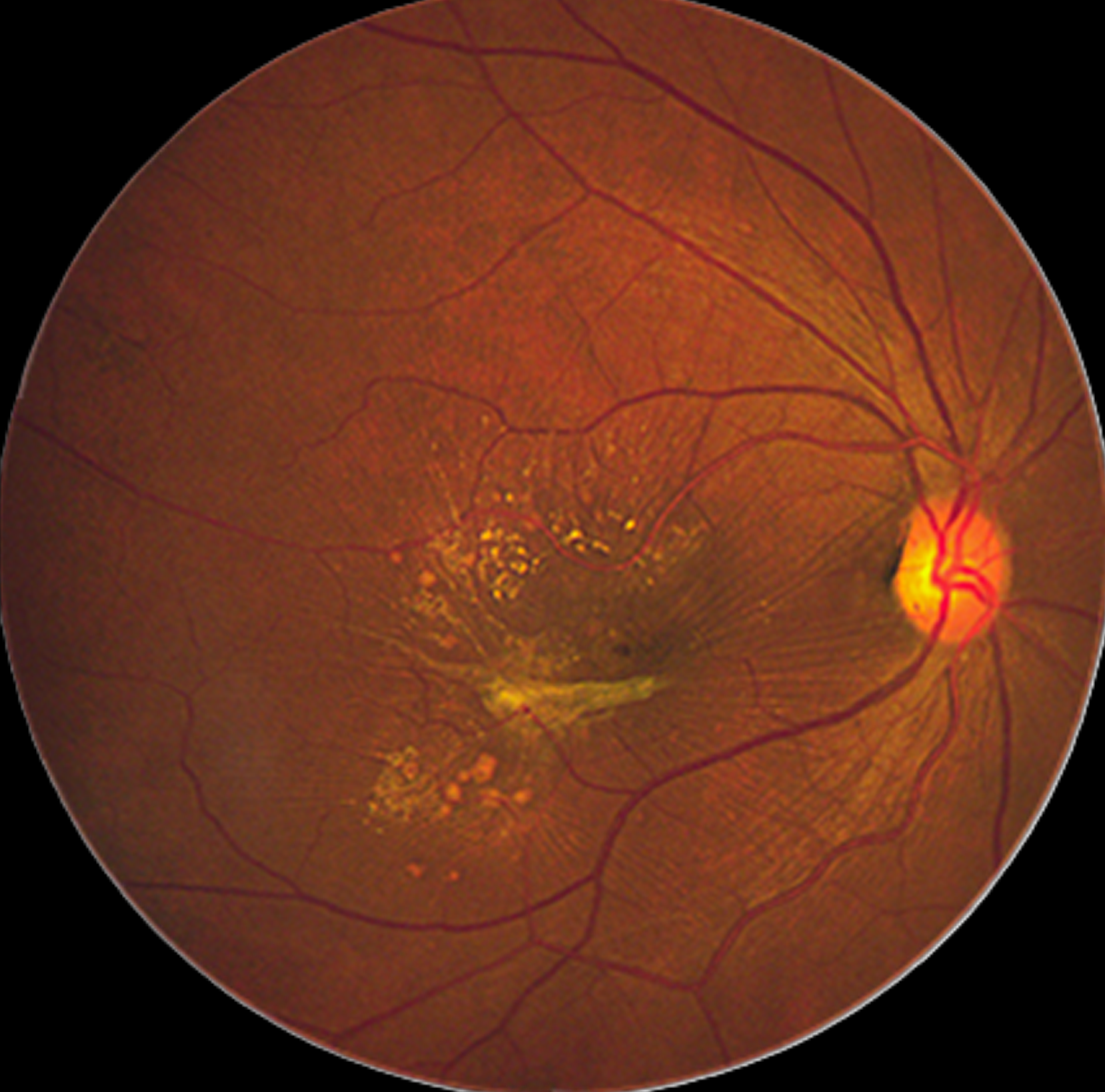 Fundus image