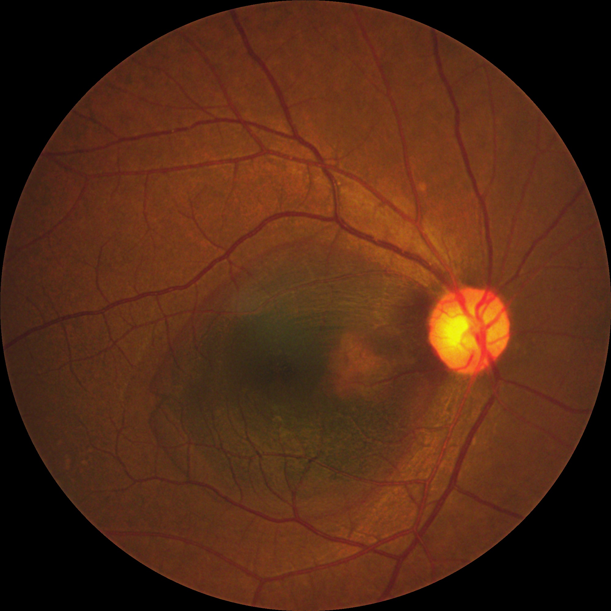Retinal image
