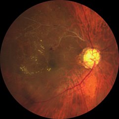 Fundus image