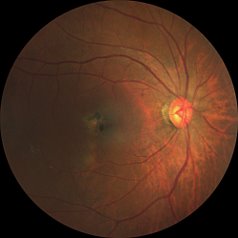 Fundus image