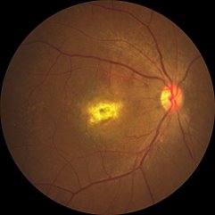 Retinal image
