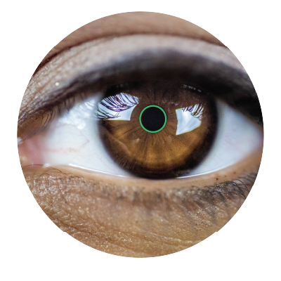 diabetic retinopathy fundus image