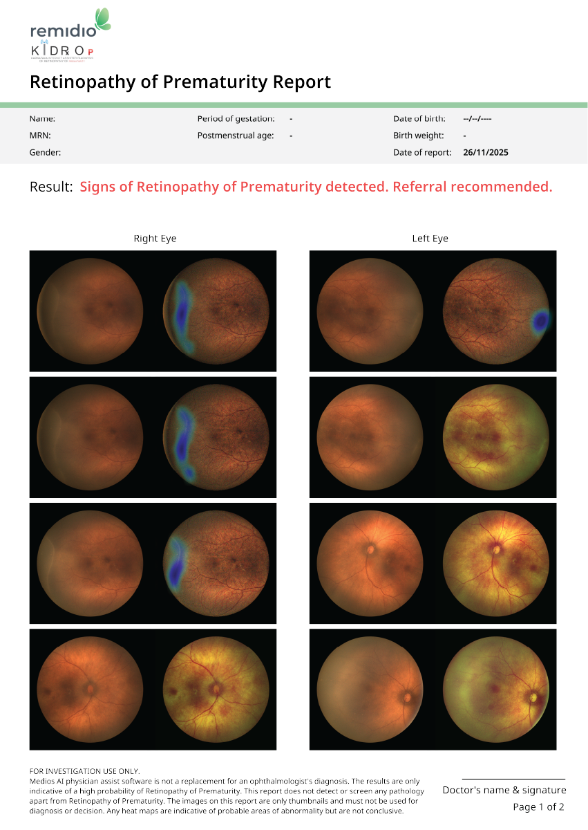 internal fixation & auto montage fundus image