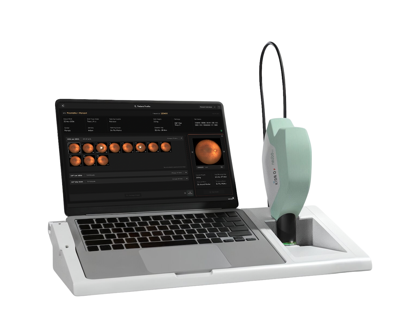 Remidio fundus  on phone