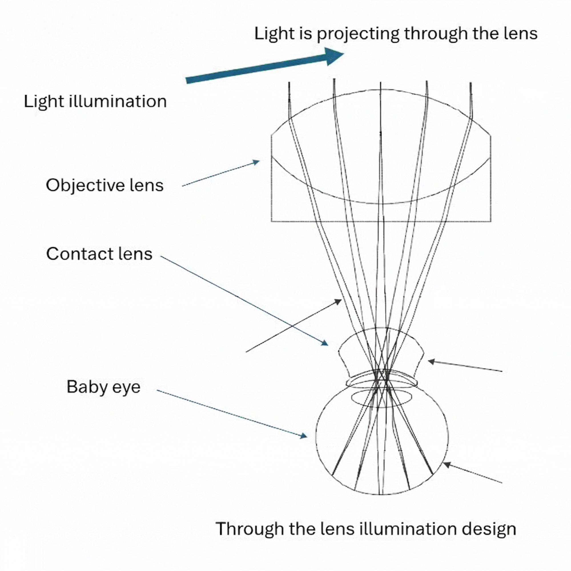internal fixation & auto montage fundus image