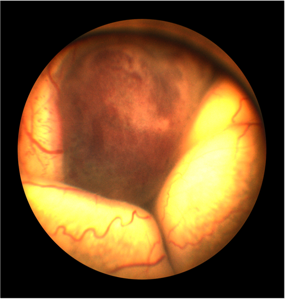 Fundus image