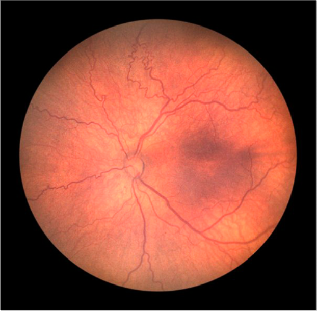 Retinal image