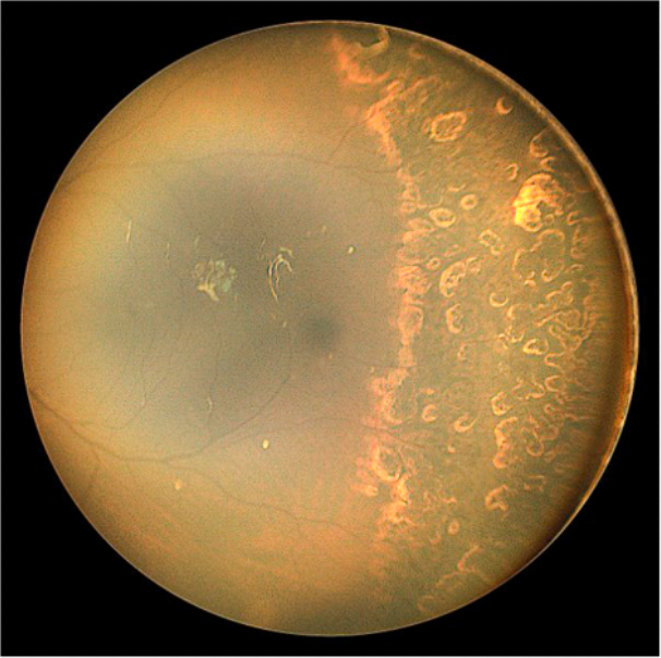Fundus image