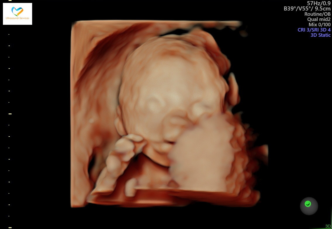 Baby Kennedy