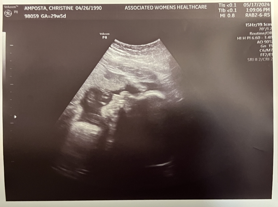 Baby Chiba #2