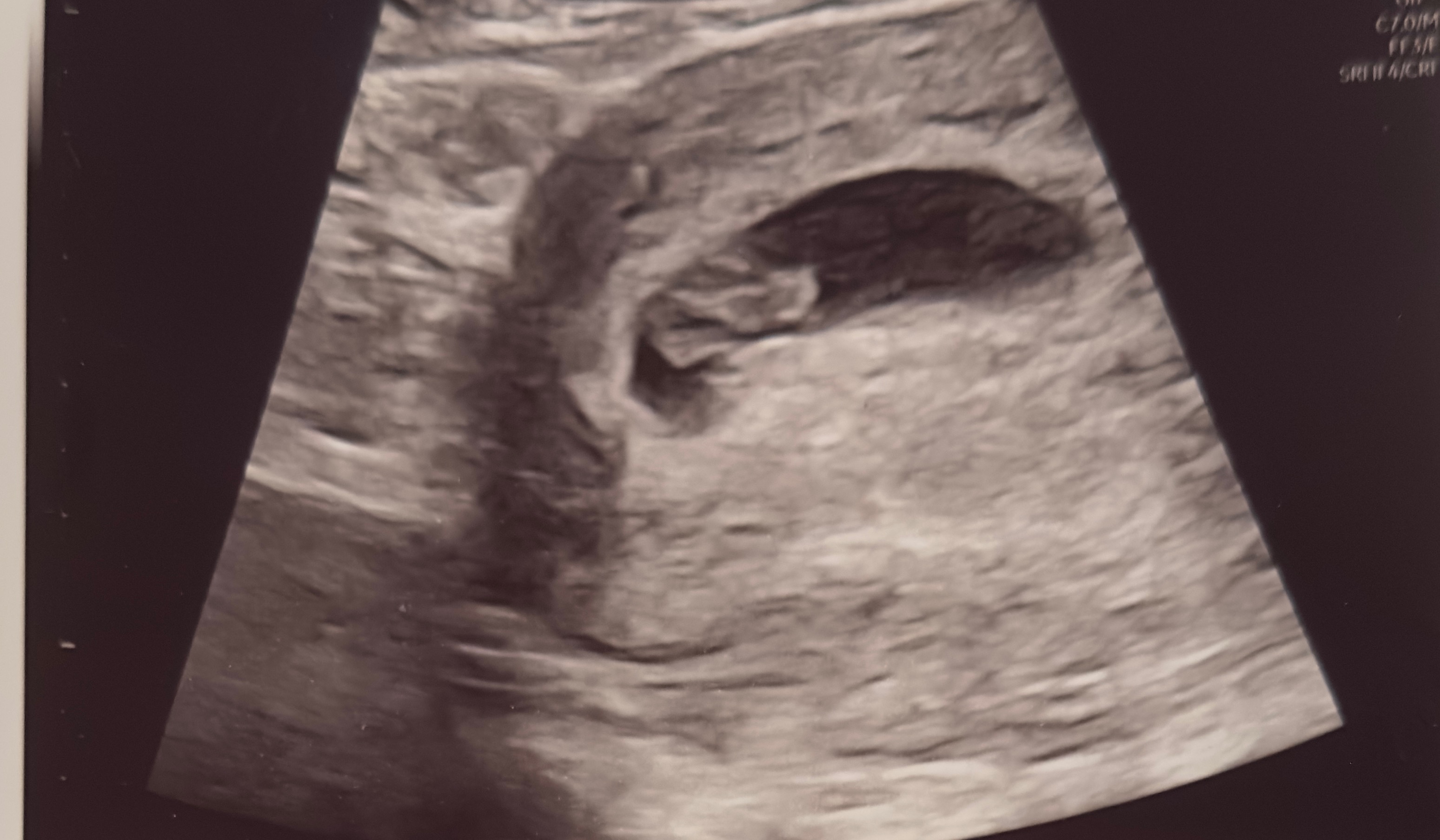 Baby Sayre