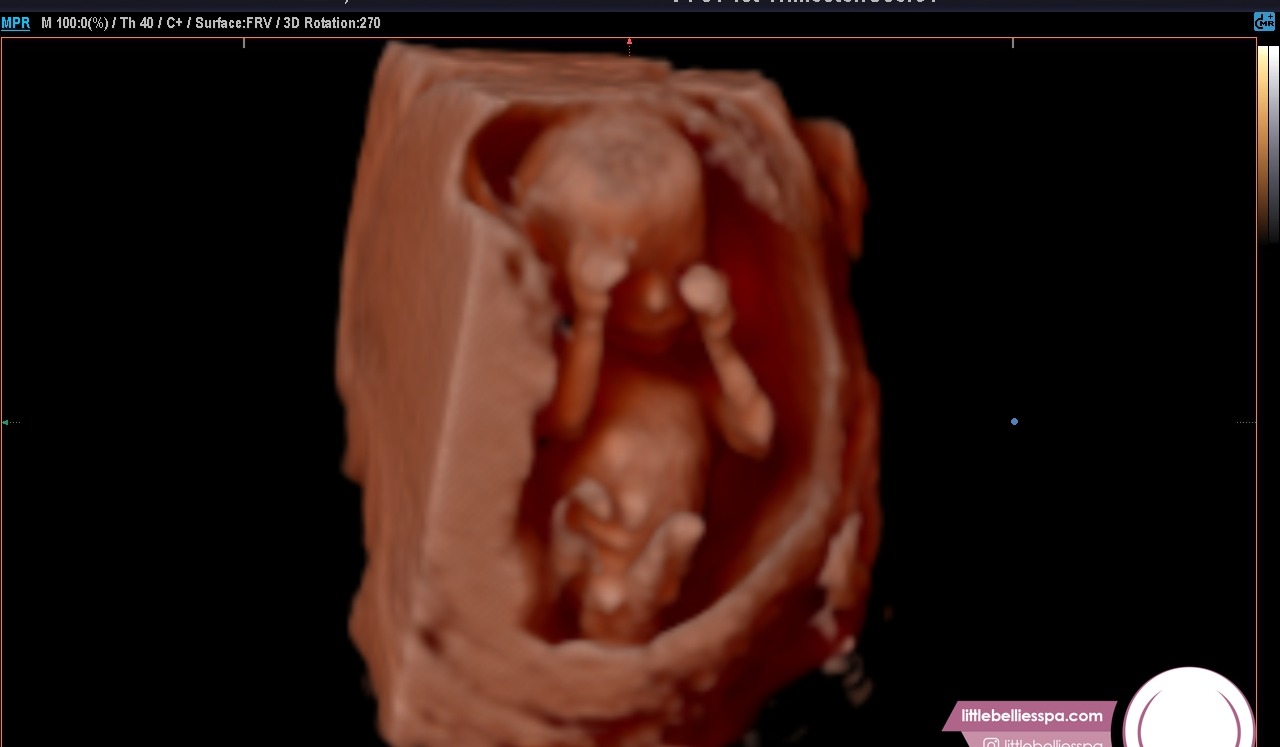 Baby Campbell