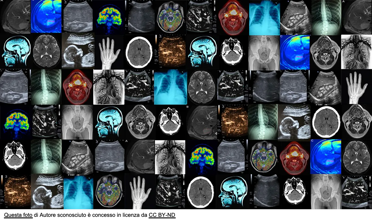 Artificial Intelligence can help diagnostics