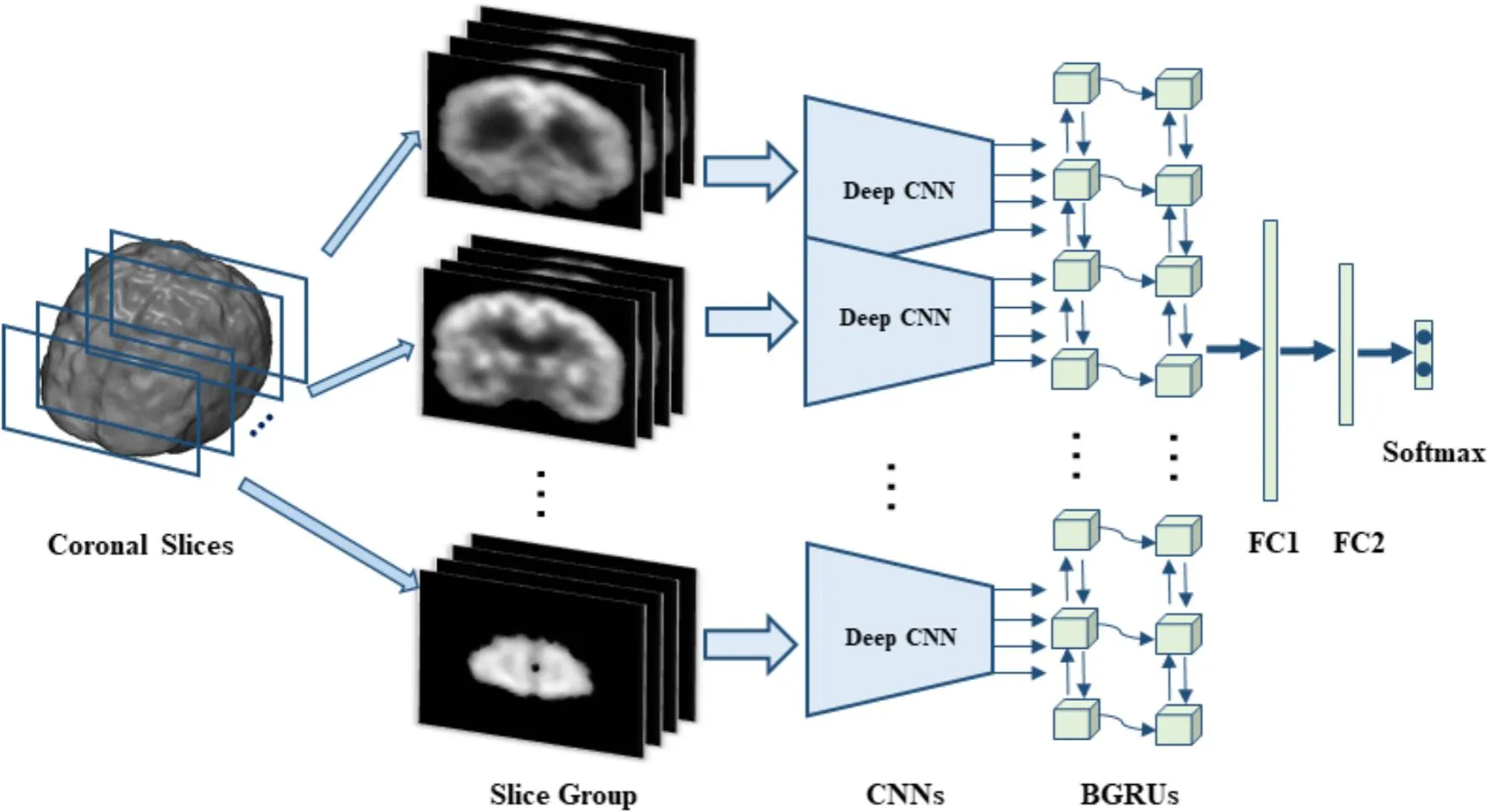 Classification of Alzheimer's Disease | doi.org/10.3389/fninf.2018.00035