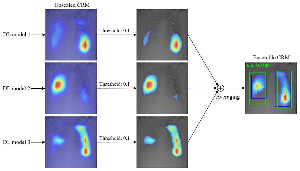 Detection and visualization of abnormality in chest radiographs using modality-specific convolutional neural network ensembles |