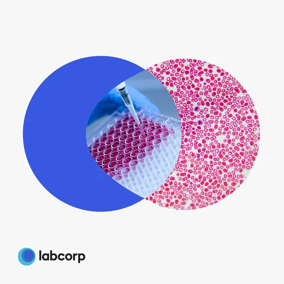 Labcorp cell and gene campaign