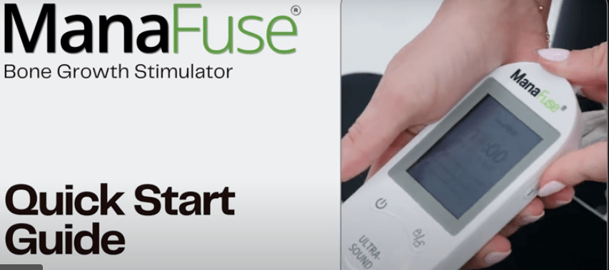 Person holding a ManaFuse Bone Growth Stimulator device with a display screen, alongside text reading Quick Start Guide.