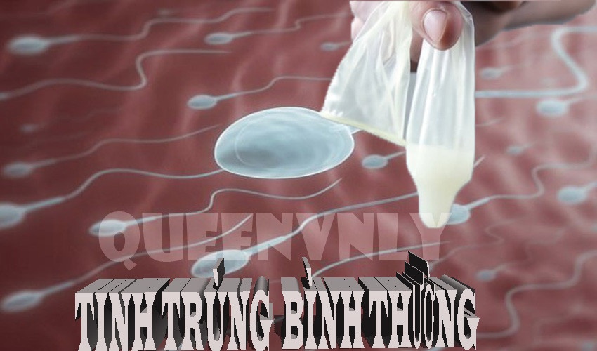 tinh trùng bình thường có màu trắng