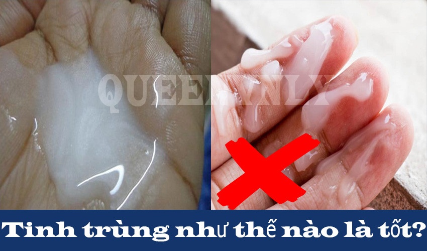 Tinh trùng như thế nào là tốt?