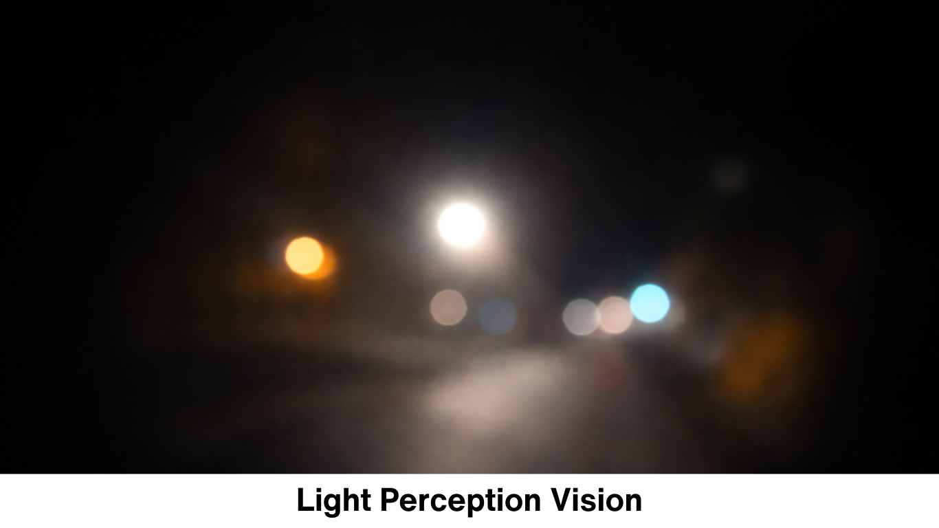 Simulation of light perception vision where only bright light sources are visible while other details remain unclear.