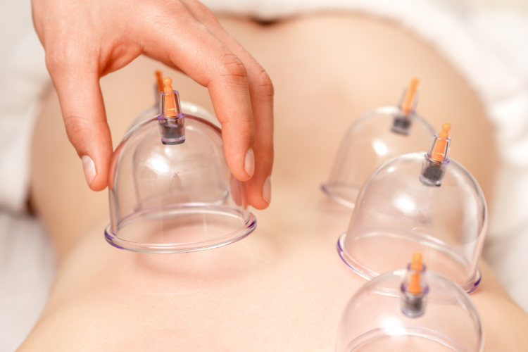 Cupping therapy for soothing tension and promoting gentle recovery