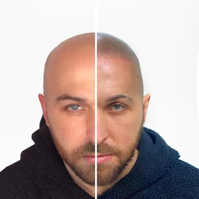before-and-after-alex-smp